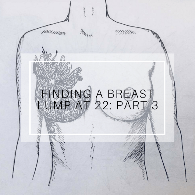Finding A Breast Lump At 22: Part 3