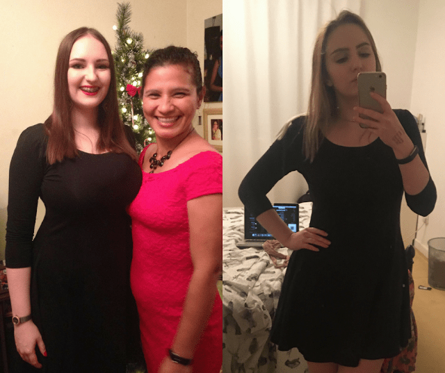 breast reduction before and after