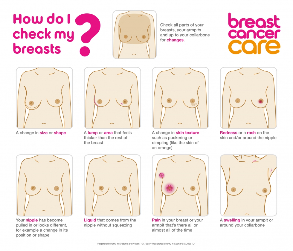 Breast cancer signs and symptoms
