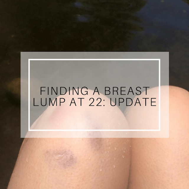 Finding A Breast Lump At 22: Part 2